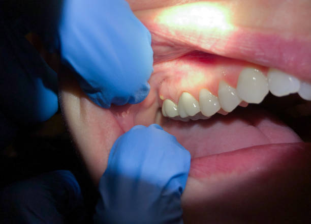 Best Emergency Broken Tooth Repair in Uvalde Estates, TX