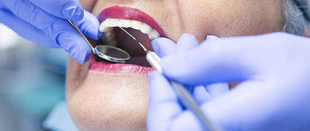 Best Emergency Tooth Extraction in Uvalde Estates, TX